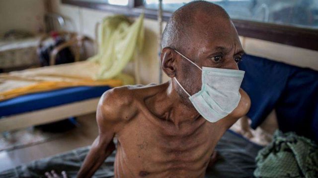 Tuberculosis- LagosPost.ng